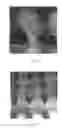 Fig. 09 - Tufted laminate web