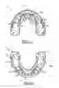 Fig. 04 - Orthodontic appliance