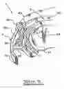 Fig. 06 - Orthodontic appliance