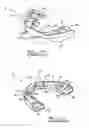Fig. 07 - Orthodontic appliance