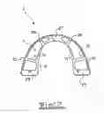 Fig. 08 - Orthodontic appliance