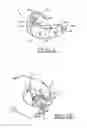 Fig. 09 - Orthodontic appliance