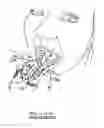 Fig. 10 - Orthodontic appliance