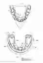 Fig. 11 - Orthodontic appliance