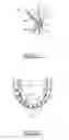 Fig. 12 - Orthodontic appliance