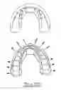 Fig. 14 - Orthodontic appliance