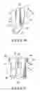 Fig. 09 - Orthodontic bracket