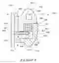 Fig. 25 - Orthodontic bracket