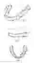Fig. 02 - ORTHODONTIC SYSTEMS WITH RESILIENT APPLIANCES