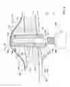 Fig. 03 - Dental implants, devices and methods associated with dental implantation procedures