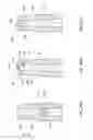 Fig. 04 - Dental implants, devices and methods associated with dental implantation procedures