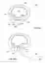 Fig. 06 - Dental implants, devices and methods associated with dental implantation procedures