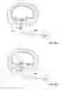 Fig. 07 - Dental implants, devices and methods associated with dental implantation procedures