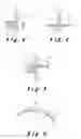 Fig. 03 - Method of preparation for restoring tooth structure