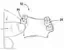 Fig. 01 - METHOD OF MAKING AN ORAL PROSTHESIS