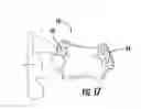 Fig. 10 - METHOD OF MAKING AN ORAL PROSTHESIS