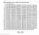 Fig. 86 - DISEASE-ASSOCIATED GENETIC VARIATIONS AND METHODS FOR OBTAINING AND USING SAME