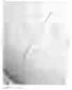 Fig. 09 - Microtiter plate to mitigate cell distribution bias from meniscus edge