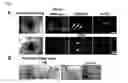 Fig. 06 - Sac-like structure enclosing hematopoietic progenitor cells produced from ES cells and method for preparing blood cells