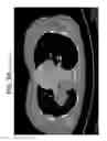Fig. 09 - Sequentially programmed magnetic field therapeutic system (SPMF)