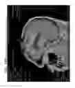 Fig. 15 - Sequentially programmed magnetic field therapeutic system (SPMF)