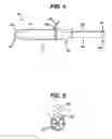 Fig. 04 - Adjustable applicator for urinary incontinence devices