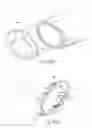 Fig. 07 - Systems and methods for optimizing and maintaining visualization of a surgical field during the use of surgical scopes