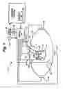 Fig. 02 - Apparatus and method for positioning and retention of catheter