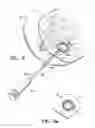 Fig. 05 - REMOTELY ACTIVATED MARKER