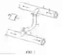 Fig. 02 - METHOD AND DEVICE FOR EASY ACCESS TO VASCULAR GRAFT CANNULATION SITES