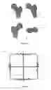 Fig. 04 - Method and device for determining a characteristic property of an anatomical structure