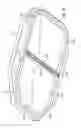 Fig. 08 - Cassette for differential pressure based medication delivery flow sensor assembly for medication delivery monitoring and method of making the same