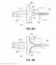 Fig. 07 - Cervical opening sealing devices