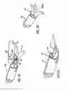 Fig. 06 - Replaceable end-effector cartridges with cam mechanisms