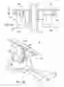 Fig. 07 - Prosthesis and Implementation System