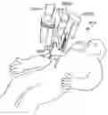Fig. 01 - MINIMALLY INVASIVE SURGICAL SYSTEM