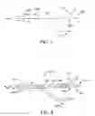 Fig. 03 - MINIMALLY INVASIVE SURGICAL SYSTEM