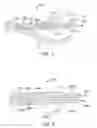 Fig. 06 - MINIMALLY INVASIVE SURGICAL SYSTEM