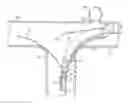 Fig. 01 - ENDOVASCULAR PROSTHESIS DELIVERY SYSTEM