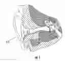 Fig. 02 - Devices for vestibular or cranial nerve stimulation