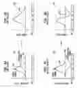 Fig. 07 - Multi-electrode channel configurations