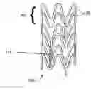 Fig. 01 - Bioabsorbable stent that modulates plaque geometric morphology and chemical composition