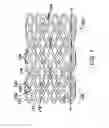 Fig. 10 - Bioabsorbable stent that modulates plaque geometric morphology and chemical composition