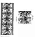 Fig. 11 - Bioabsorbable stent that modulates plaque geometric morphology and chemical composition