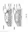 Fig. 24 - Bioabsorbable stent that modulates plaque geometric morphology and chemical composition