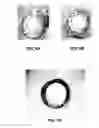 Fig. 06 - Coatings for implantable devices having a chromium oxide layer and a method of forming the same
