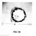 Fig. 07 - Coatings for implantable devices having a chromium oxide layer and a method of forming the same
