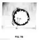 Fig. 07 - COATING FOR IMPLANTABLE DEVICES AND A METHOD OF FORMING THE SAME