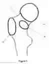 Fig. 02 - Method for determining an arrangement of measurement points on an anatomical structure