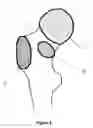 Fig. 04 - Method for determining an arrangement of measurement points on an anatomical structure